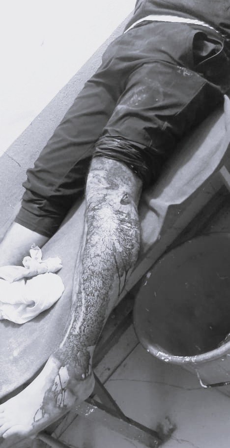 राष्ट्रिय युवा संघ नेपाल बाजुरा संयोजक माथि आक्रमण