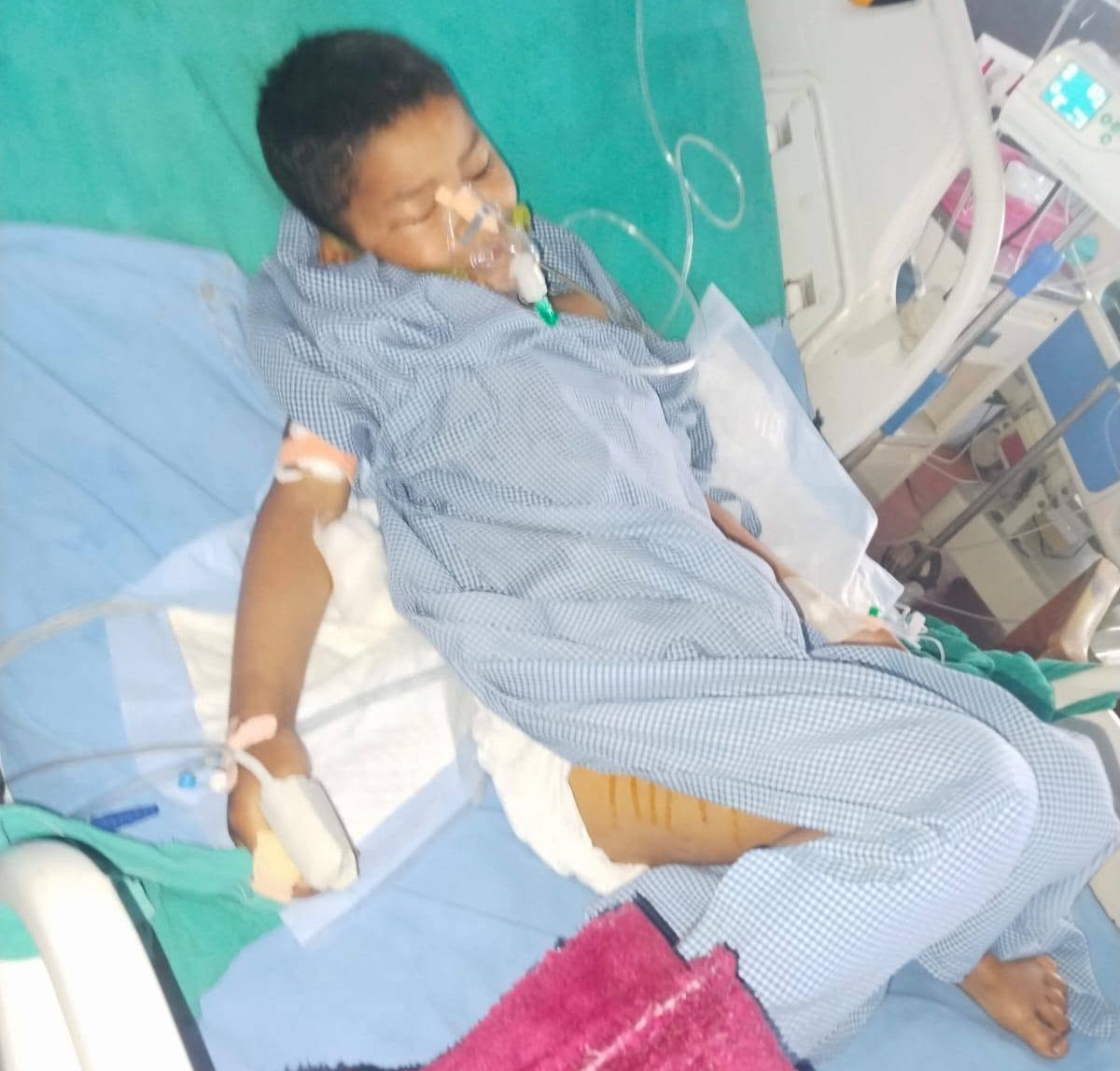 भीरबाट खसेर गम्भीर घाइते सुरेन्द्रको आन्द्रा फुट्यो, जीवन बचाउन सहयोगी मनको खाँचो