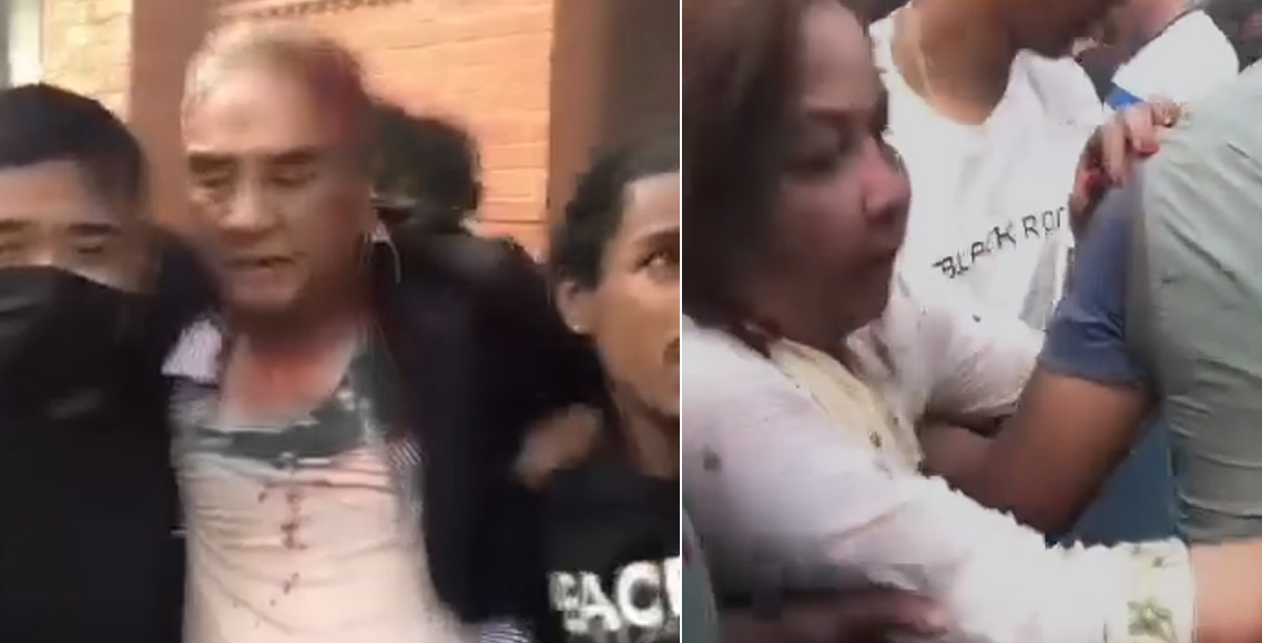 देउवाको टाउँकोमा १२ टाँका लगाइयो